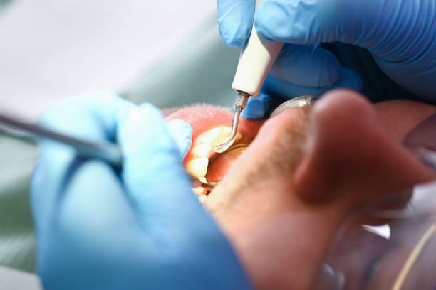 Best Emergency Dental Services for Seniors in Mino, CA